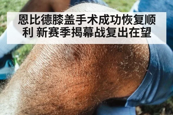 恩比德膝盖手术成功恢复顺利 新赛季揭幕战复出在望